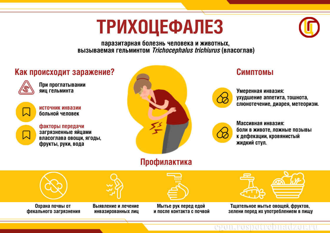 Трихоцефалез