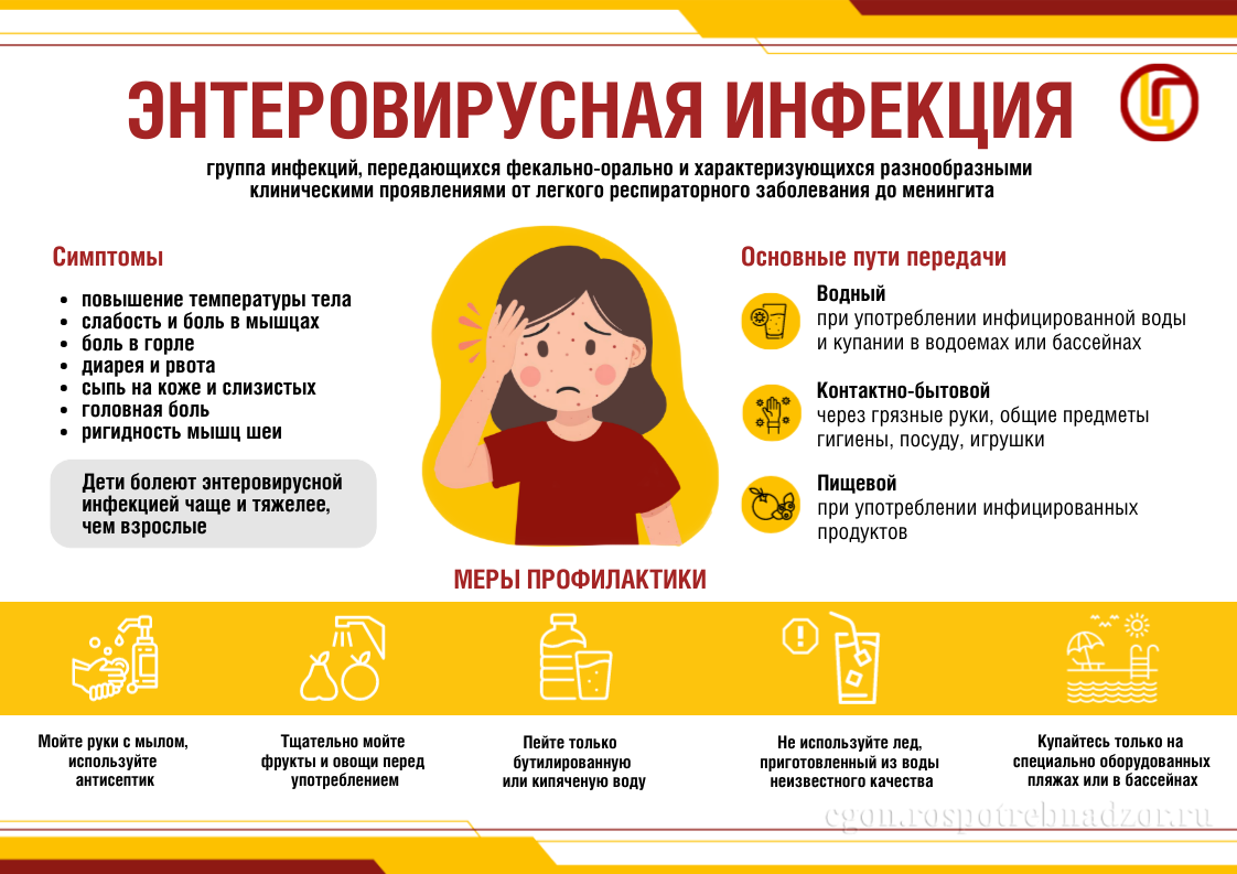 Энтеровирусная инфекция
