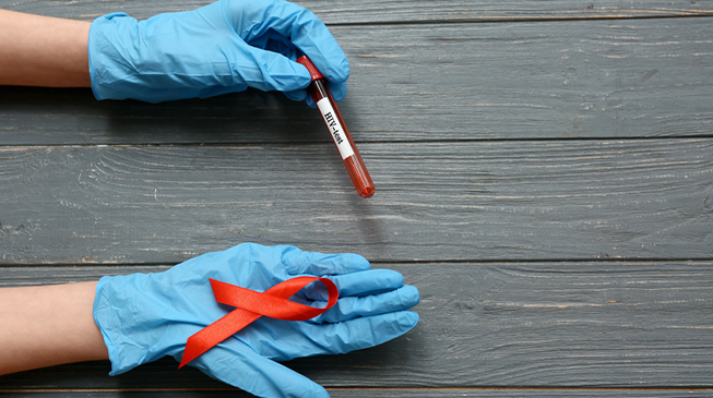 Зачем нужно знать свой ВИЧ статус